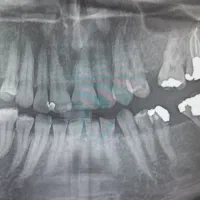 دعوت به همکاری دندانپزشک  (دارای دستگاه OPG)