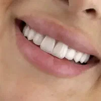 نیازمند پروانه و مجوز دندانسازی