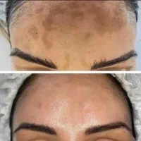 قبل و بعد خانم اکرادی
