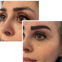 کاشت تخصصی ابرو (تخفیفی باور نکردنی)
