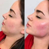 کلینیک زیبایی ژل فیلربادی نخ بوتاکس لیزرلاغری قسطی