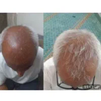 خرج اضافه نکن برای رویش موهات