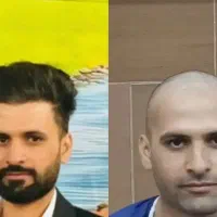 کاشت مو طبیعی و ترمیم