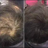 برگشت تضمینی مجدد موهاتون