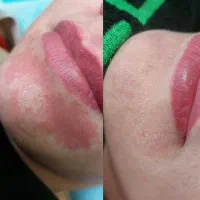 آموزش خدمات زیبایی و اسکین تراپی از صفر تا حرفه ای