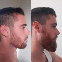 پرپشتی با ما تجربه کن