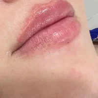 آموزش وتزریقات ( ژل و بوتاکس )پیرسینگ و میکرودرمال