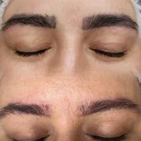 تخفیف ریموو تخصصی تتو در ماه محرم و صفر