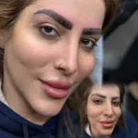 ۹۸۰تومان میکروبلیدینگ فیبروز کرکی