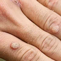 چراهنوزبه نتیجع نرسیدی