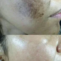 نمایندگی رسمی محصولات بیوممتیک (اصلی) مشهد
