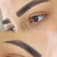 مرکز تخصصی فیبروز ابرو (پیگمنترزهراعبدالملکی)