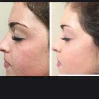 آموزش پاکسازی و فشیال مجازی