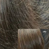 موخوره‌گیری حرفه‌ای با تضمین نرمی مو