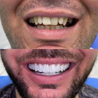 مشاوره دندانپزشکی ( رایگان )