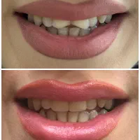 مطب دندانپزشکی دکتر رویا نبی پور