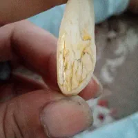 مهره نگین انگشتر