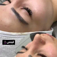فیشال پوست /درمان لک و تیرگی
