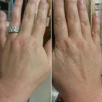 بیوممتیک ضدچین وچروک 5کاره+پرداخت امن