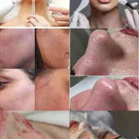 آموزش فشیال و پدیکور (مطب)