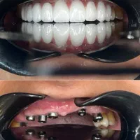 مرکز ایمپلنت و دندانپزشکی تخصصی