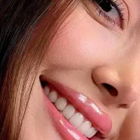 کامپوزیت دندانپزشکی عصبکشی روکش تهرانسر یافت آباد