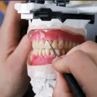 نیرو برای لابراتوار دندانسازی