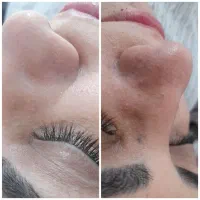 ماسک( پاکسازی ، فیشال )