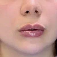 نیازمند مدل رایگان فیلر لب به روش M