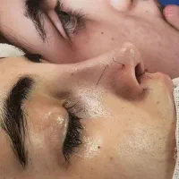 جشنواره جراحی بینی با دستگاه پیزوسرجری سبک اروپای