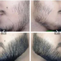 چسب ریش|آرایشی، بهداشتی، درمانی|بجنورد, |دیوار