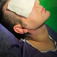 ساکشن غبغب بوکالفت بلفاروپلاستی و تزریق چربی|خدمات زیبایی و سلامت|تهران, صادقیه|دیوار