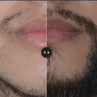 رویش و پرپشتی ریش