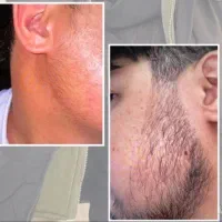بیبی فیس نباش