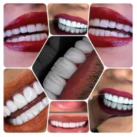 درمانگاه دندانپزشکی/کف قیمتی/طرف قراردادبیمه ها
