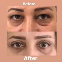 بهترین خدمات زیبایی و لاغری در رشت