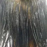 درمان ریشه ای و کامل شپش به صورت اصولی در یک جلسه