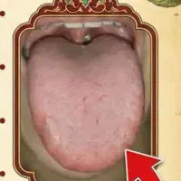 تشخیص بیماری از روی زبان
