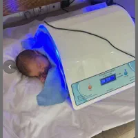 اجاره دستگاه زردی نوزاد(فتوتراپی)