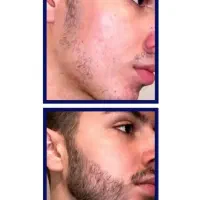 با پشمالویی که فاصله ای نداری