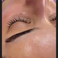 زیبایی صورت...تخفیف واقعا استثنایی