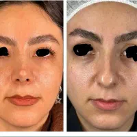 جشنواره جراحی بینی و زیبایی و تیپ پلاستی