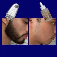 سرم تخصصی رویش ریش