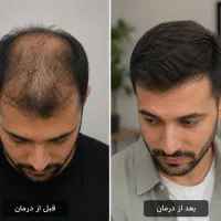 با صابون و شامپو عوض کردن درست نمیشه