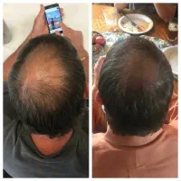کف سرتو پر کن