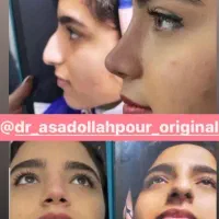 عمل  بینی    دکتر اسد الله پور     فقط(29.500)