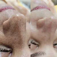 آف ۵۰ درصدی فیشیال کلاسیک