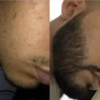ریشات با من