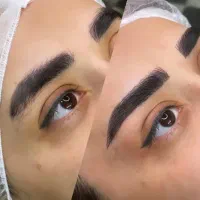 مدل فیبروز میکروبلبدینگ ۱۳۰۰