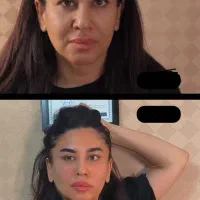 جشنواره فیلر فیلرطبیعی جوانساز ژل  روشن کننده لب